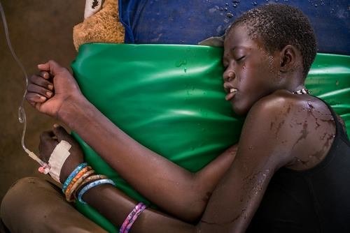 أطباء بلا حدود : مئات الآلاف معرضون للإصابة بمرض الملاريا في جنوب السودان