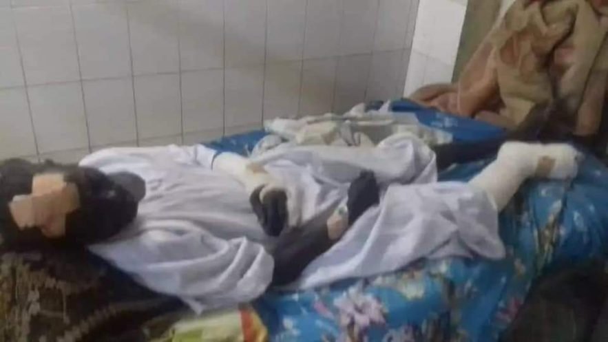 أحد المصابين من كمبو "جعيرين" بمحلية جنوب الجزيرة